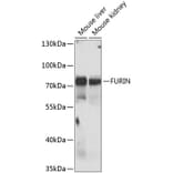 Western Blot - Anti-FURIN Antibody (A7445) - Antibodies.com