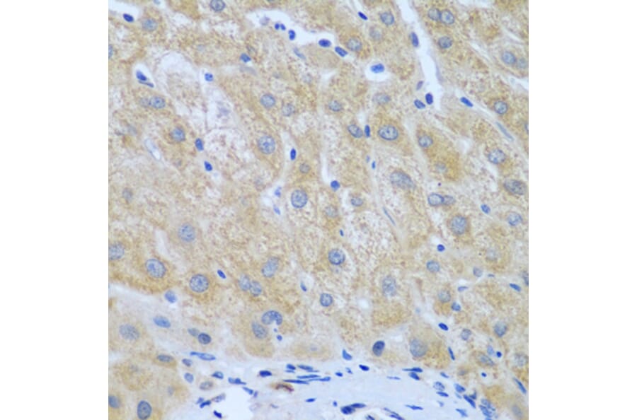 Immunohistochemistry - Anti-FURIN Antibody (A7445) - Antibodies.com