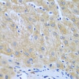 Immunohistochemistry - Anti-FURIN Antibody (A7445) - Antibodies.com