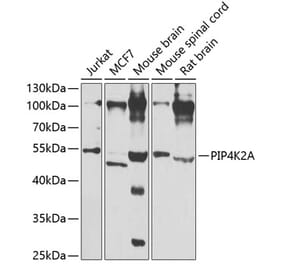 Western Blot - Anti-PIP4K2A Antibody (A15704) - Antibodies.com