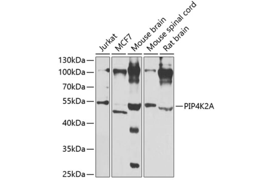 Western Blot - Anti-PIP4K2A Antibody (A15704) - Antibodies.com