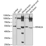 Western Blot - Anti-PIP4K2A Antibody (A15704) - Antibodies.com