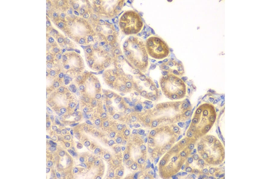 Immunohistochemistry - Anti-PIP4K2A Antibody (A15704) - Antibodies.com