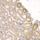 Immunohistochemistry - Anti-PIP4K2A Antibody (A15704) - Antibodies.com