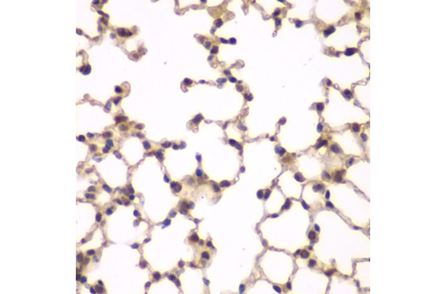 Immunohistochemistry - Anti-PIP4K2A Antibody (A15704) - Antibodies.com