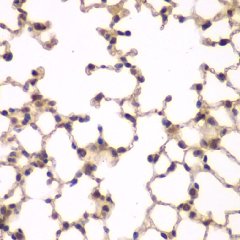 Immunohistochemistry - Anti-PIP4K2A Antibody (A15704) - Antibodies.com