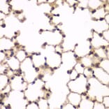 Immunohistochemistry - Anti-PIP4K2A Antibody (A15704) - Antibodies.com