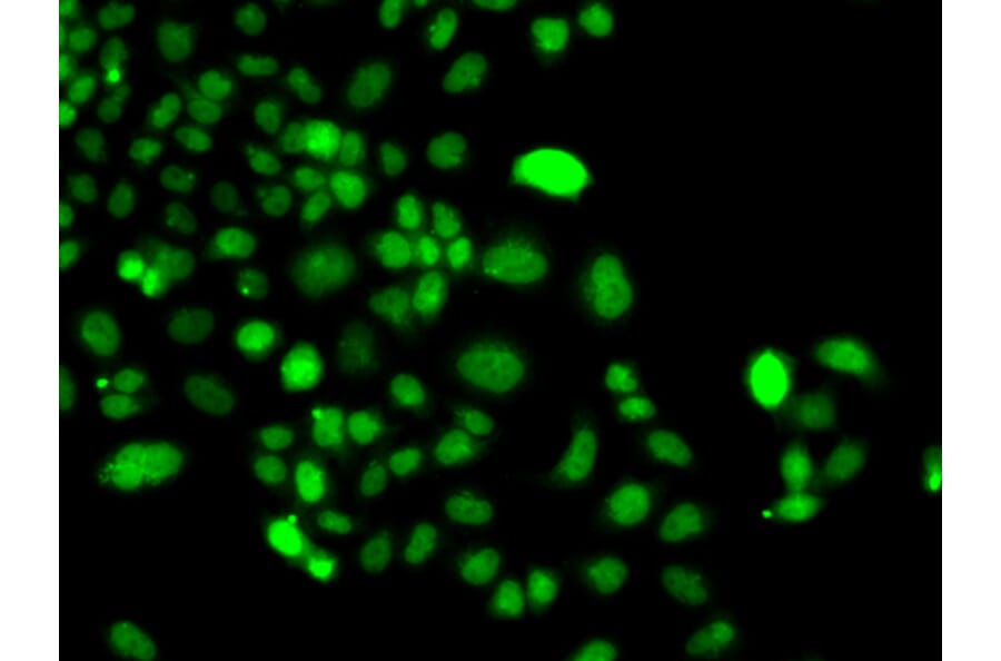 Immunofluorescence - Anti-PIP4K2A Antibody (A15704) - Antibodies.com