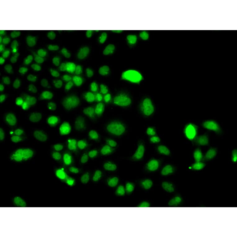 Immunofluorescence - Anti-PIP4K2A Antibody (A15704) - Antibodies.com