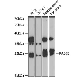 Western Blot - Anti-Rab5b Antibody (A15705) - Antibodies.com