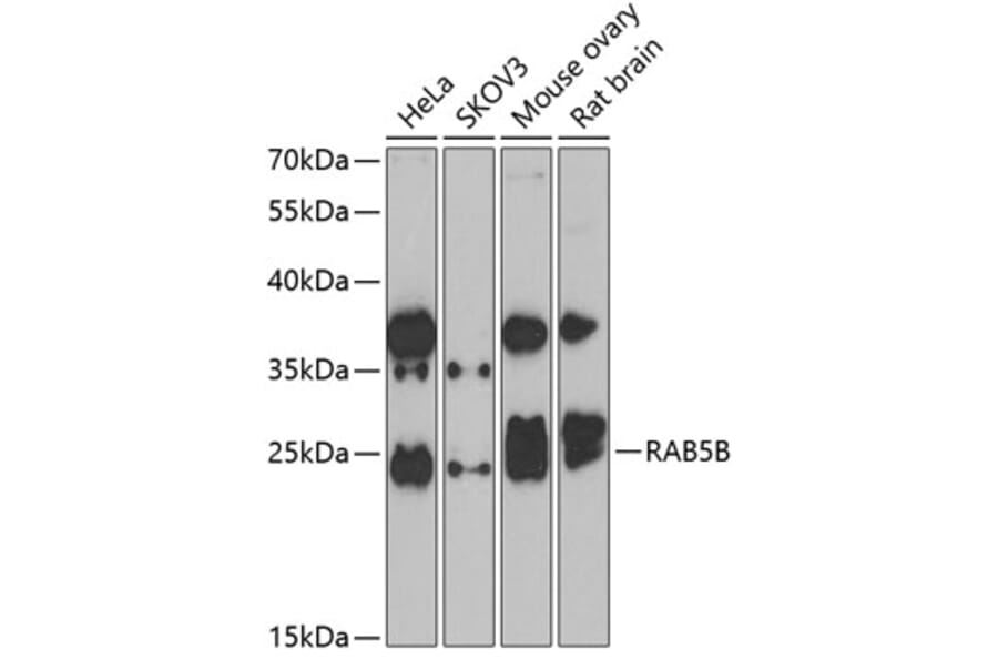Western Blot - Anti-Rab5b Antibody (A15705) - Antibodies.com