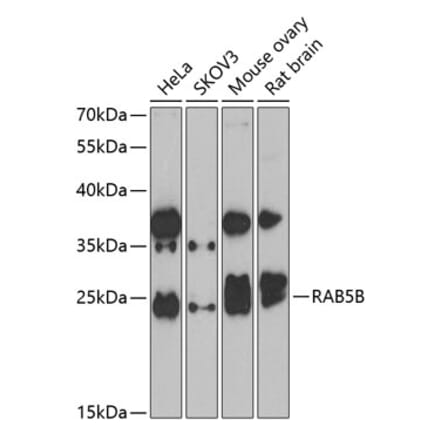 Western Blot - Anti-Rab5b Antibody (A15705) - Antibodies.com