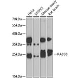 Western Blot - Anti-Rab5b Antibody (A15705) - Antibodies.com