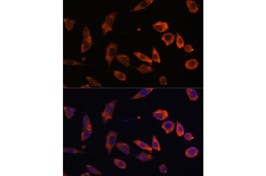 Immunofluorescence - Anti-Rab5b Antibody (A15705) - Antibodies.com