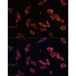Immunofluorescence - Anti-Rab5b Antibody (A15705) - Antibodies.com