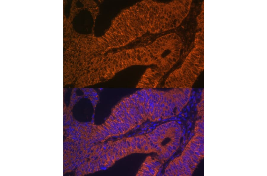 Immunofluorescence - Anti-Rab5b Antibody (A15705) - Antibodies.com