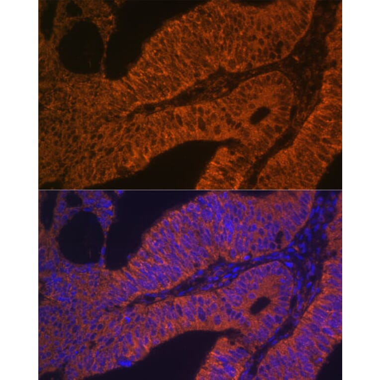 Immunofluorescence - Anti-Rab5b Antibody (A15705) - Antibodies.com