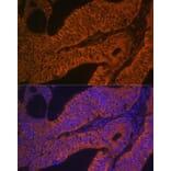 Immunofluorescence - Anti-Rab5b Antibody (A15705) - Antibodies.com