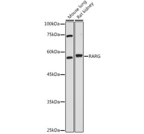 Western Blot - Anti-Retinoic Acid Receptor gamma Antibody (A15706) - Antibodies.com