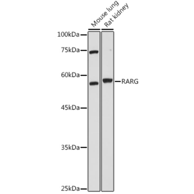 Western Blot - Anti-Retinoic Acid Receptor gamma Antibody (A15706) - Antibodies.com