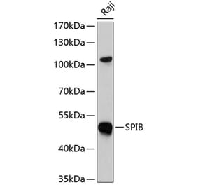 Western Blot - Anti-SPIB Antibody (A7451) - Antibodies.com