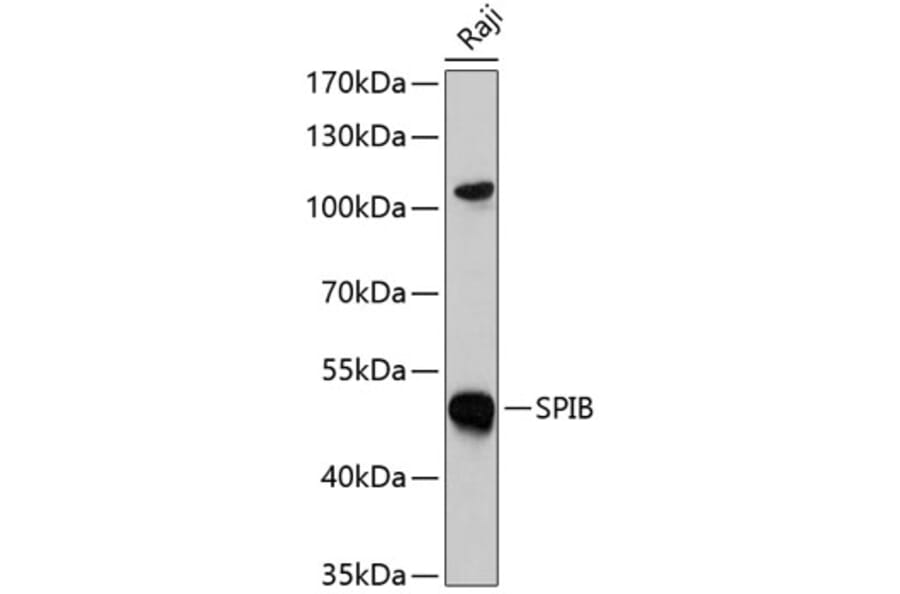 Western Blot - Anti-SPIB Antibody (A7451) - Antibodies.com