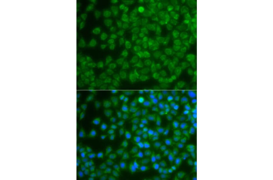 Immunofluorescence - Anti-SPIB Antibody (A7451) - Antibodies.com