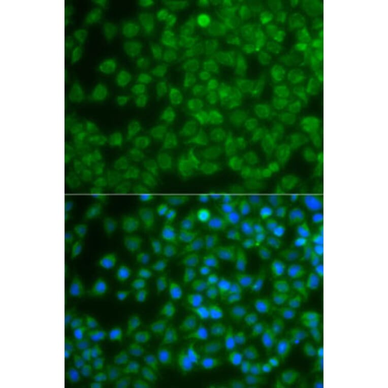 Immunofluorescence - Anti-SPIB Antibody (A7451) - Antibodies.com