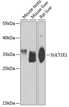 Western blot analysis of extracts of various cell lines, using Anti-SULT1E1 Antibody (A7452) at 1:1,000 dilution.
Secondary antibody: Goat Anti-Rabbit IgG (H+L) (HRP) (AS014) at 1:10,000 dilution.
Lysates / proteins: 25µg per lane.
Blocking buffer: 3% non-fat dry milk in TBST.
Detection: ECL Basic Kit (RM00020).
Exposure time: 90s.