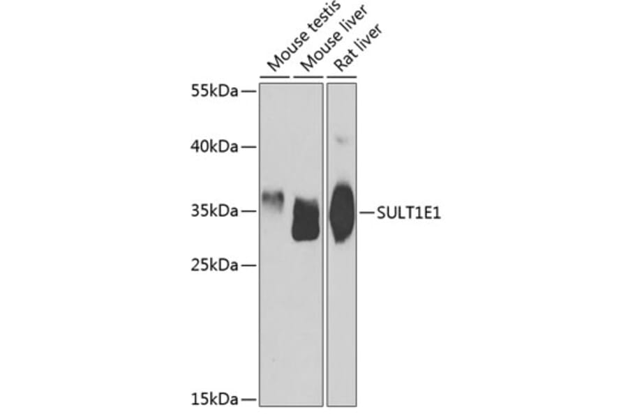Western Blot - Anti-Estrogen Sulfotransferase Antibody (A15709) - Antibodies.com