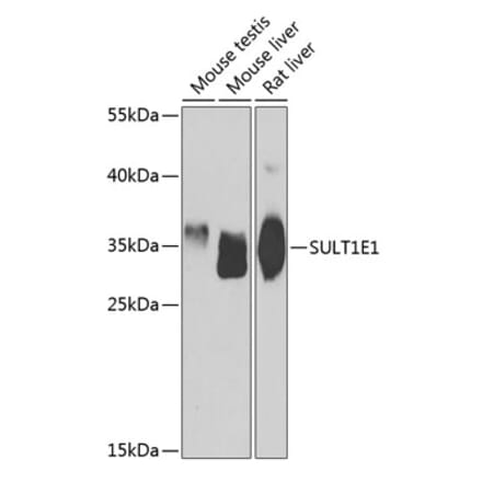Western Blot - Anti-Estrogen Sulfotransferase Antibody (A15709) - Antibodies.com