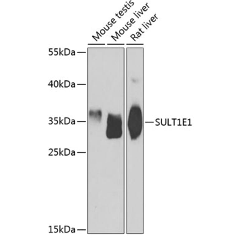 Western Blot - Anti-Estrogen Sulfotransferase Antibody (A15709) - Antibodies.com