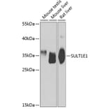 Western Blot - Anti-Estrogen Sulfotransferase Antibody (A15709) - Antibodies.com