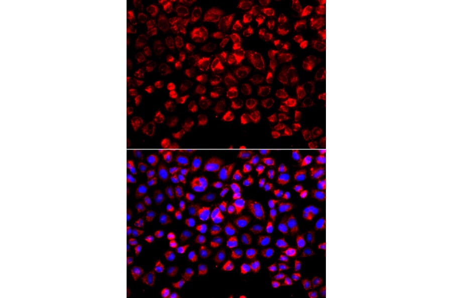 Immunofluorescence - Anti-Estrogen Sulfotransferase Antibody (A15709) - Antibodies.com
