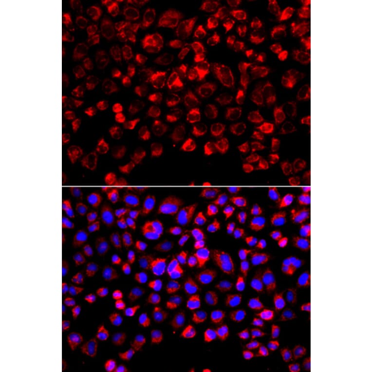 Immunofluorescence - Anti-Estrogen Sulfotransferase Antibody (A15709) - Antibodies.com
