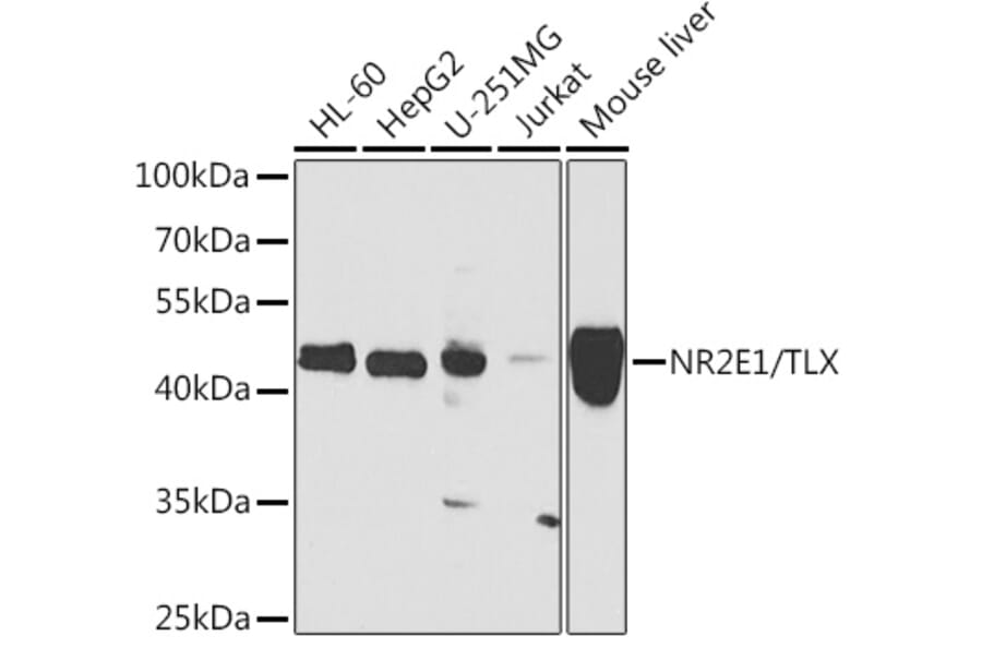 Western Blot - Anti-NR2E1/Tailless/TLX Antibody (A15710) - Antibodies.com
