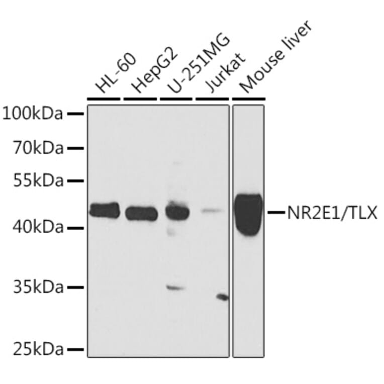 Western Blot - Anti-NR2E1/Tailless/TLX Antibody (A15710) - Antibodies.com