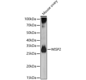 Western Blot - Anti-WISP2 Antibody (A15711) - Antibodies.com