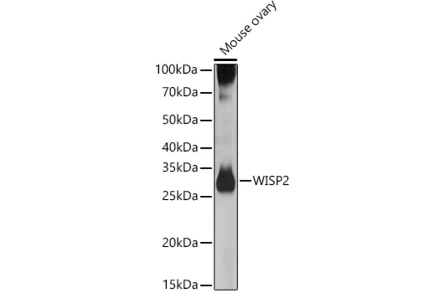 Western Blot - Anti-WISP2 Antibody (A15711) - Antibodies.com