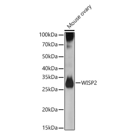 Western Blot - Anti-WISP2 Antibody (A15711) - Antibodies.com