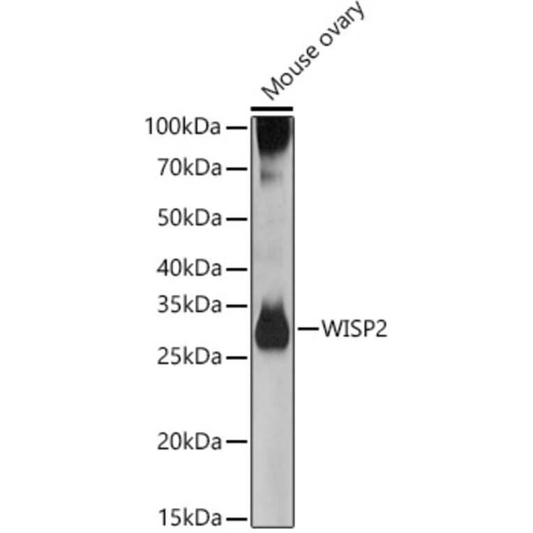 Western Blot - Anti-WISP2 Antibody (A15711) - Antibodies.com