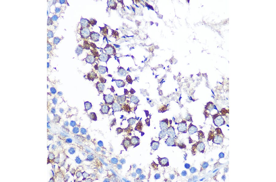 Immunohistochemistry - Anti-WISP2 Antibody (A15711) - Antibodies.com