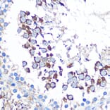 Immunohistochemistry - Anti-WISP2 Antibody (A15711) - Antibodies.com