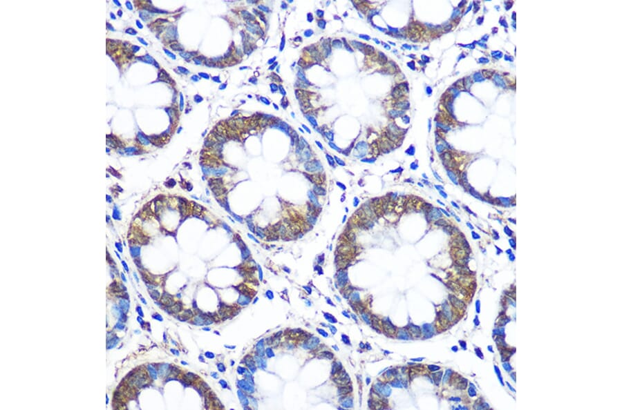 Immunohistochemistry - Anti-WISP2 Antibody (A15711) - Antibodies.com