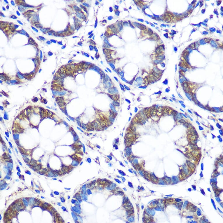 Immunohistochemistry - Anti-WISP2 Antibody (A15711) - Antibodies.com