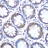 Immunohistochemistry - Anti-WISP2 Antibody (A15711) - Antibodies.com