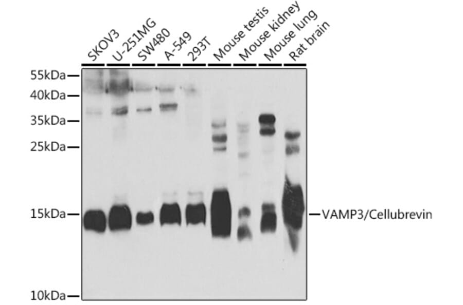 Western Blot - Anti-Cellubrevin Antibody (A15712) - Antibodies.com