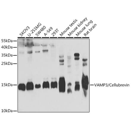 Western Blot - Anti-Cellubrevin Antibody (A15712) - Antibodies.com