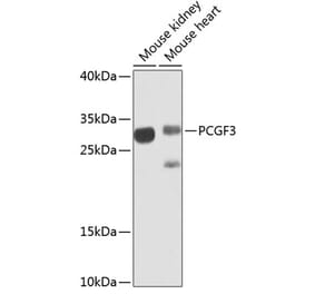 Western Blot - Anti-PCGF3 Antibody (A15714) - Antibodies.com