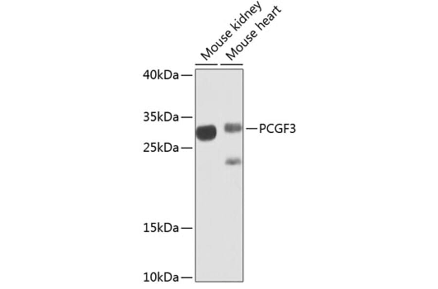 Western Blot - Anti-PCGF3 Antibody (A15714) - Antibodies.com